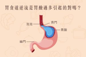 Read more about the article 小知識｜胃食道逆流是胃酸過多引起的嗎？