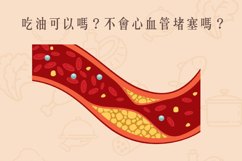 Read more about the article 小知識｜吃油可以嗎？不會心血管堵塞嗎？